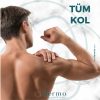 Tüm Kol