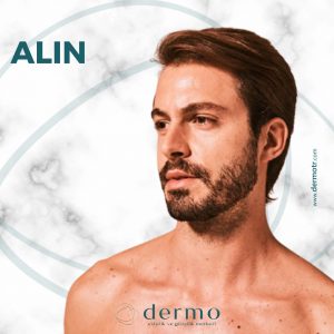Alın