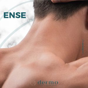 Ense